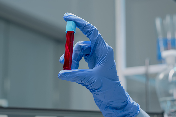 Blood Bank